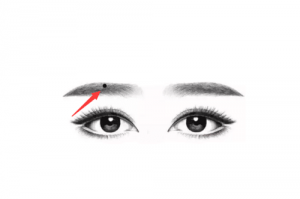 锁眉痣代表什么意义 锁眉痣代表什么意思?
